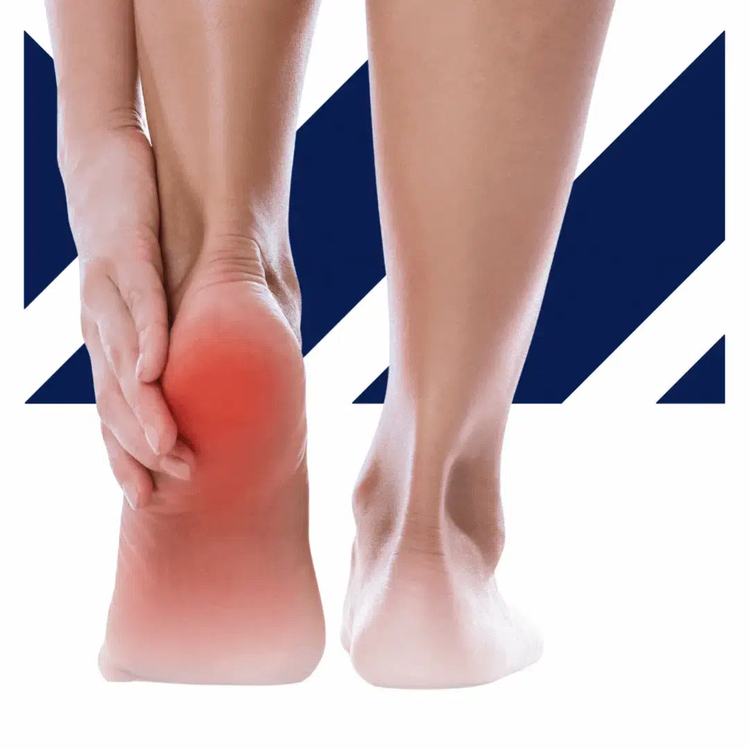 Neuropathy care in Florida Neuropathy care in Florida