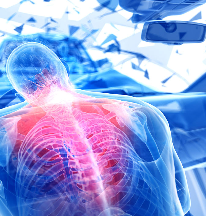 champion wellness auto accident care visual impact