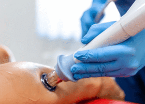 DIY Shockwave Therapy vs. In Clinic Treatment post 1