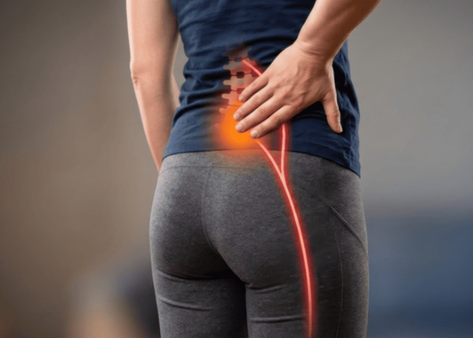 Injections vs. Chiropractic Care for Sciatica in Trinity post